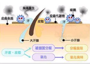 腋臭病因.jpg